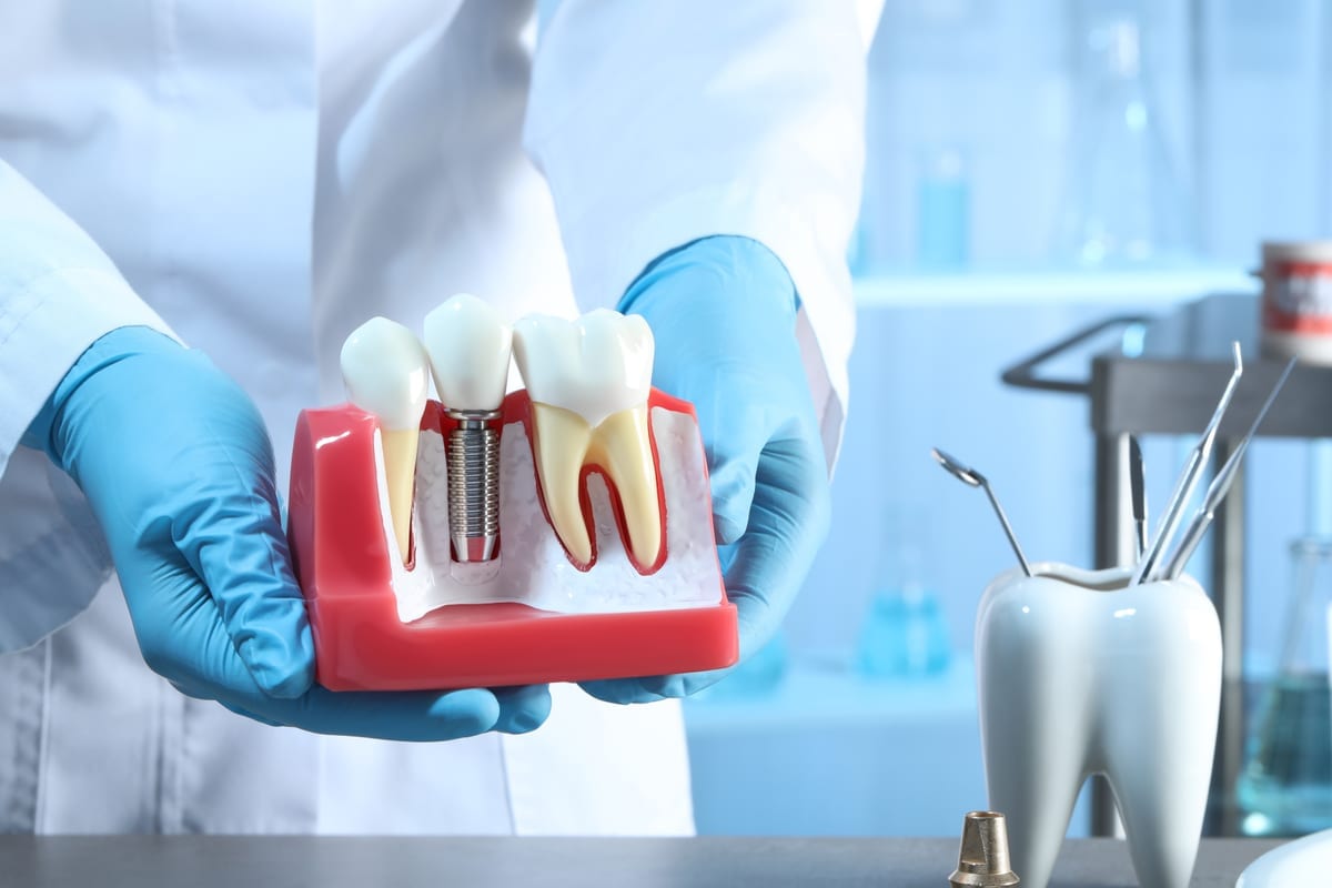 Dental Implant Costs in Beach Park, IL