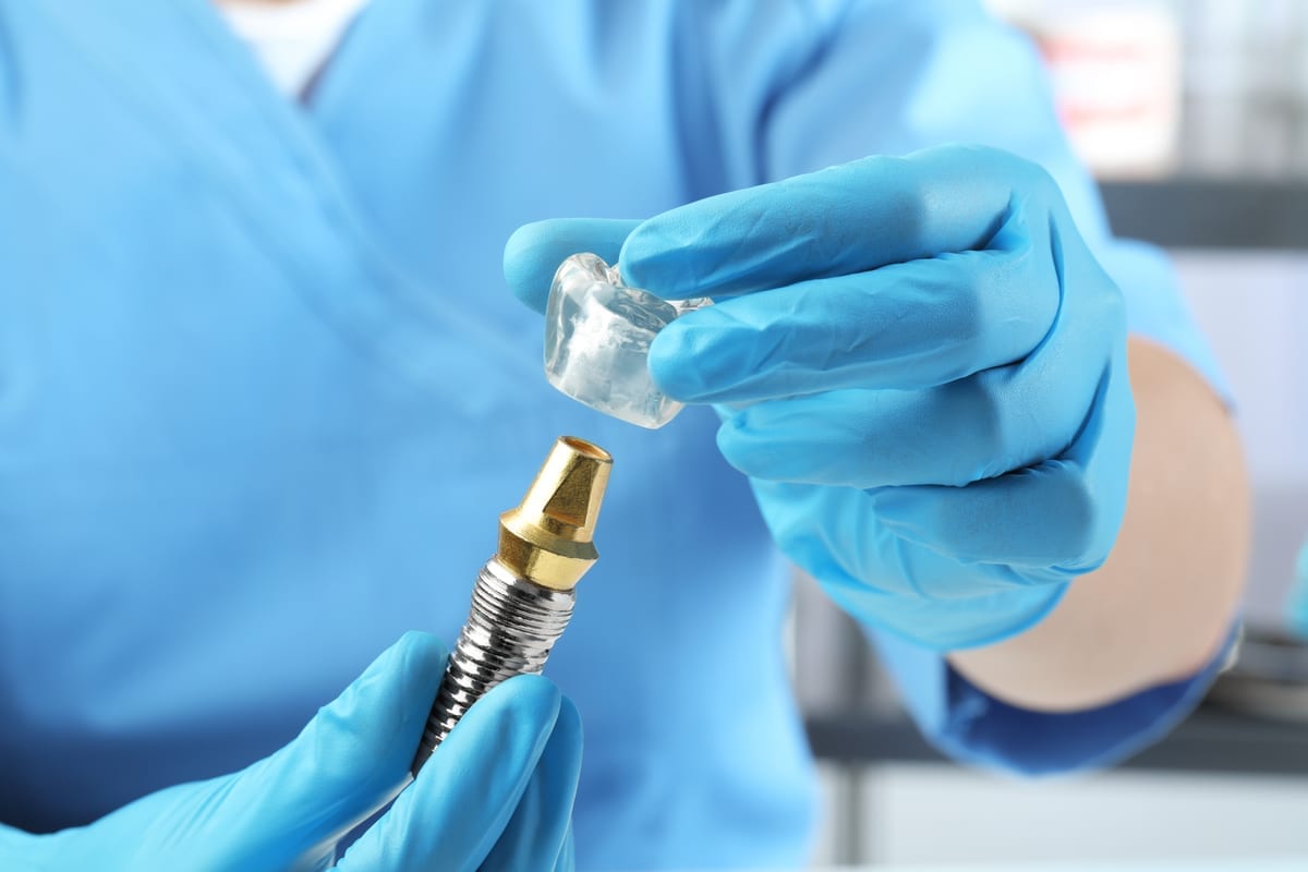 Dental Implants vs. Dentures in Waukegan, IL