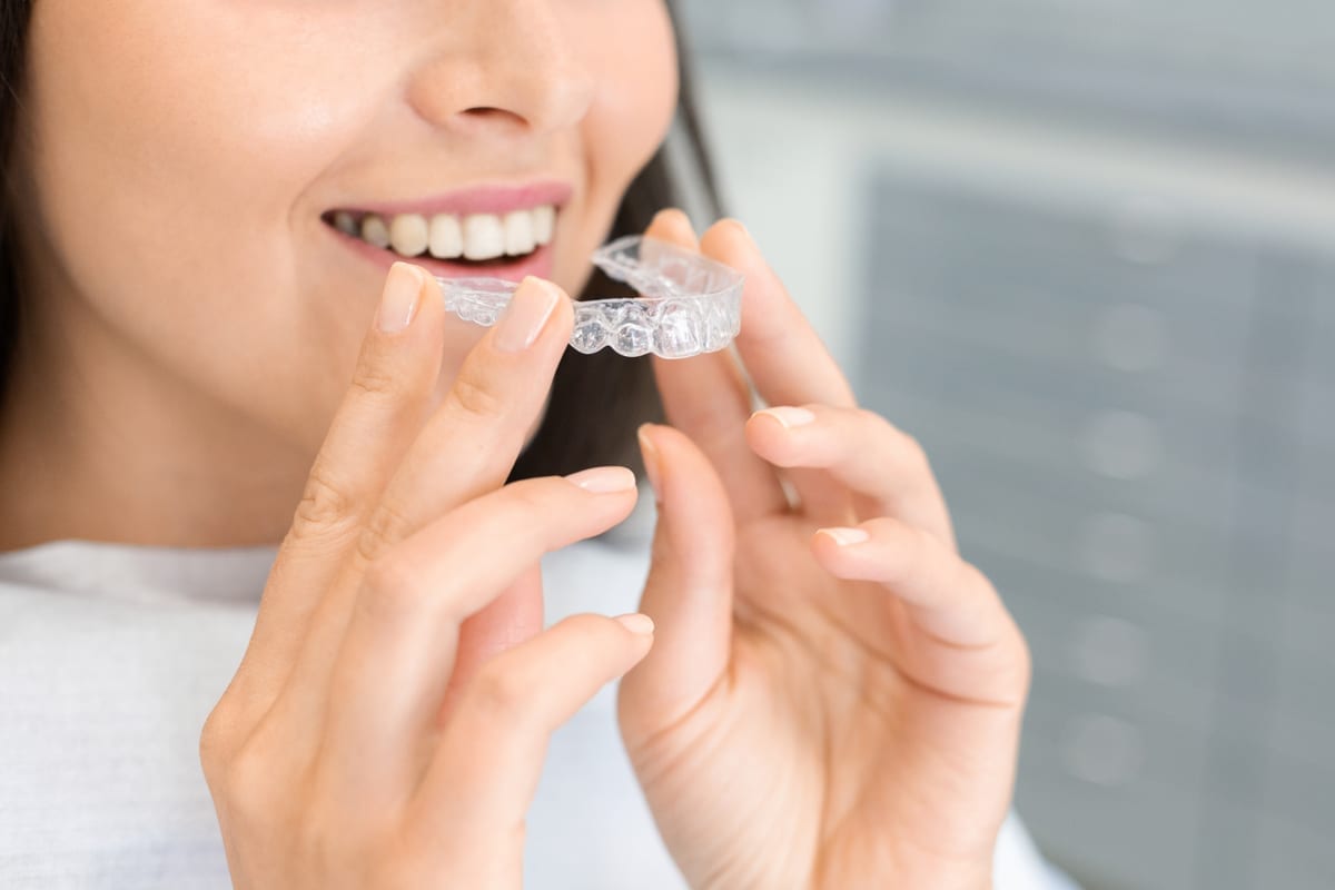 Your Invisalign Timeline: Compliance Secrets That Speed Up Results